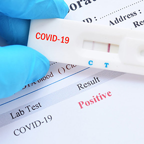 ¿Son fiables los test de antígenos?